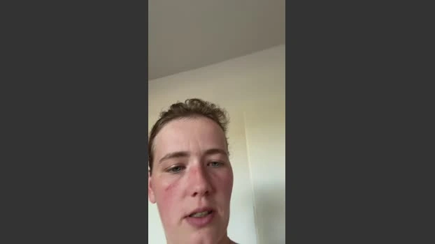 Pepaar26_hot
